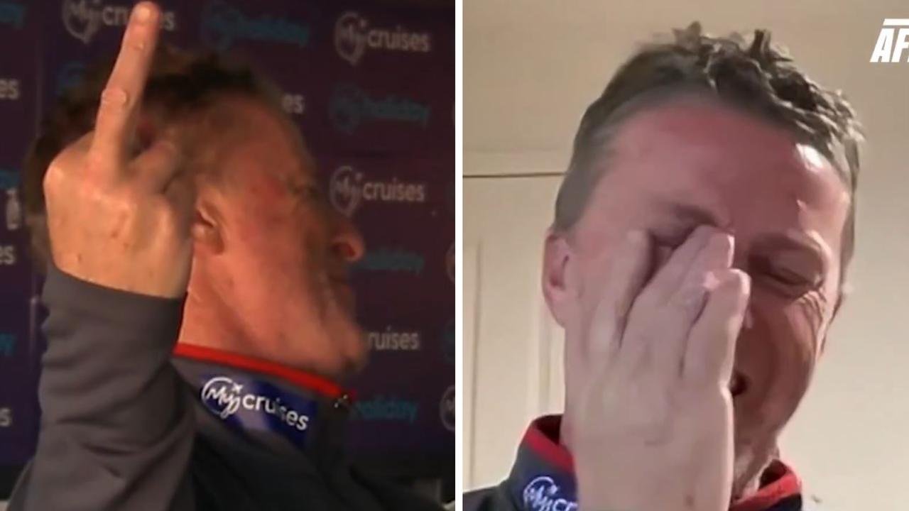Damien's reaction hardwick to the turn in the loss of golden gold at Giganti, the middle finger, AFL 360, the latest news